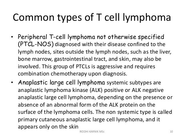 T cell lymphomas ppt