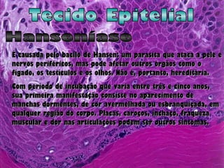 Tecido Epitelial Hanseníase É causada pelo bacilo de Hansen: um parasita que ataca a pele e nervos periféricos, mas pode afetar outros órgãos como o fígado, os testículos e os olhos. Não é, portanto, hereditária.  Com período de incubação que varia entre três e cinco anos, sua primeira manifestação consiste no aparecimento de manchas dormentes, de cor avermelhada ou esbranquiçada, em qualquer região do corpo. Placas, caroços, inchaço, fraqueza muscular e dor nas articulações podem ser outros sintomas. 