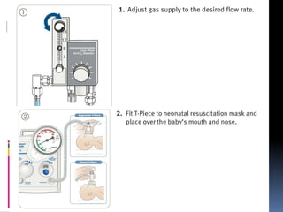 Fio2 T Piece T piece resuscitator | PPTX