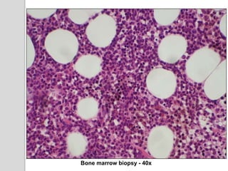 Bone marrow biopsy - 40x
 