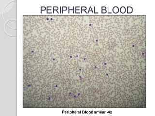PERIPHERAL BLOOD
Peripheral Blood smear -4x
 