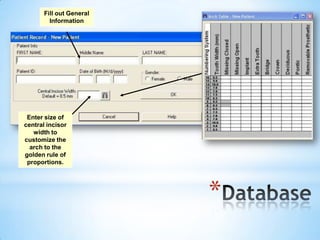 Fill out General
Information

Enter size of
central incisor
width to
customize the
arch to the
golden rule of
proportions.

*

 