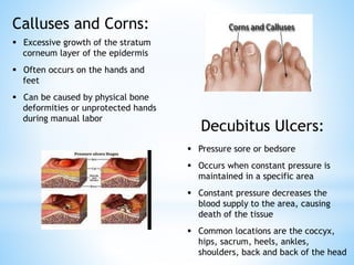 Calluses and Corns:
 Excessive growth of the stratum
corneum layer of the epidermis
 Often occurs on the hands and
feet
 Can be caused by physical bone
deformities or unprotected hands
during manual labor
Decubitus Ulcers:
 Pressure sore or bedsore
 Occurs when constant pressure is
maintained in a specific area
 Constant pressure decreases the
blood supply to the area, causing
death of the tissue
 Common locations are the coccyx,
hips, sacrum, heels, ankles,
shoulders, back and back of the head
 