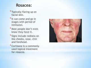 *Typically flaring up on
facial skin.
*It can come and go in
stages with period of
remission.
*Most people don’t even
know they have it.
*Signs include redness on
the cheeks, nose, chin
and forehead.
*Cortisone is a commonly
used topical treatment
for rosacea.
Rosacea:
 