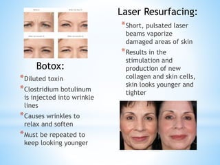 *Diluted toxin
*Clostridium botulinum
is injected into wrinkle
lines
*Causes wrinkles to
relax and soften
*Must be repeated to
keep looking younger
*Short, pulsated laser
beams vaporize
damaged areas of skin
*Results in the
stimulation and
production of new
collagen and skin cells,
skin looks younger and
tighter
Botox:
Laser Resurfacing:
 