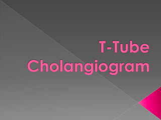 T-Tube Cholangiogram 