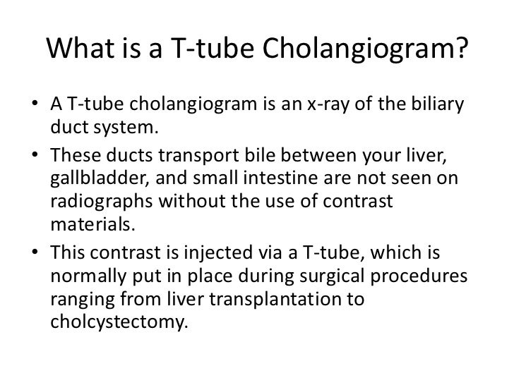 T-tube Cholangiogram