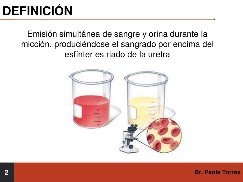 Hematuria