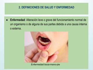 2. DEFINICIONES DE SALUD Y ENFERMEDAD
● Enfermedad: Alteración leve o grave del funcionamiento normal de
un organismo o de alguna de sus partes debida a una causa interna
o externa.
Enfermedad boca-mano-pie
 