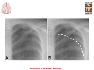 Department of Pulmonary Medicine
 