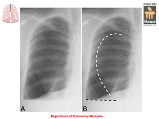 Department of Pulmonary Medicine
 