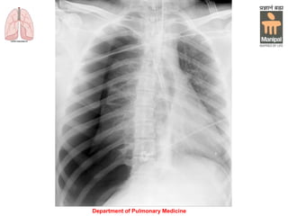 Department of Pulmonary Medicine
 