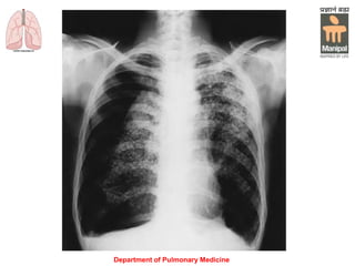 Department of Pulmonary Medicine
 