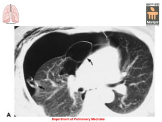 Department of Pulmonary Medicine
 
