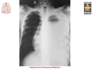Department of Pulmonary Medicine
 