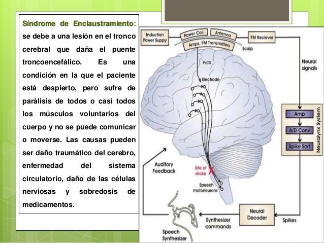 Resultado de imagen para enclaustramiento