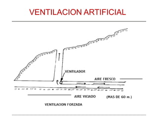VENTILACION ARTIFICIAL
 