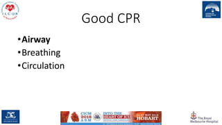 Good CPR
•Airway
•Breathing
•Circulation
37
 