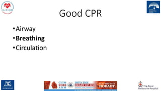 Good CPR
•Airway
•Breathing
•Circulation
41
 