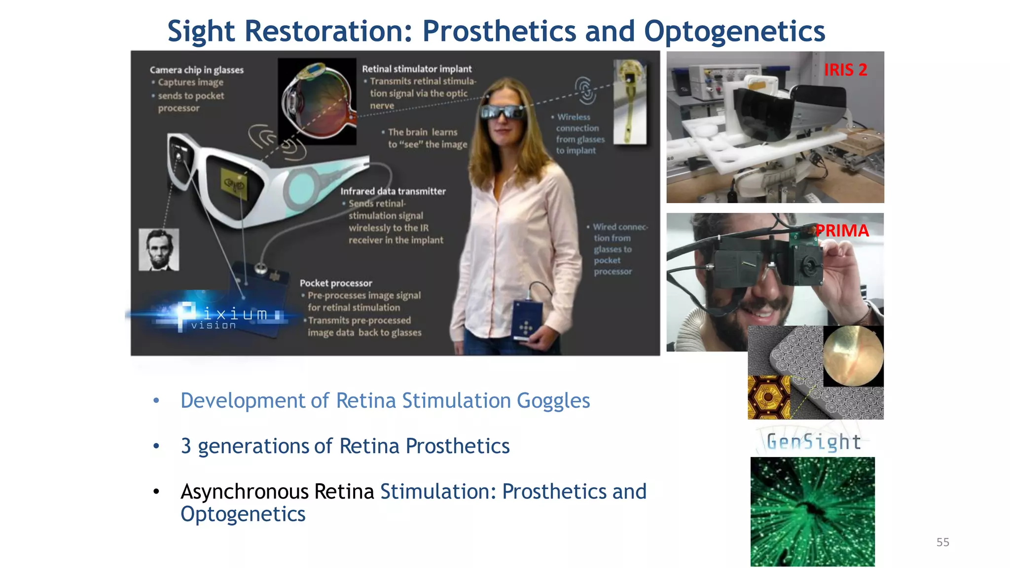 Sight Restoration: Prosthetics and Optogenetics
• Development of Retina Stimulation Goggles
• 3 generations of Retina Prosthetics
• Asynchronous Retina Stimulation: Prosthetics and
Optogenetics
IRIS 2
PRIMA
55
 