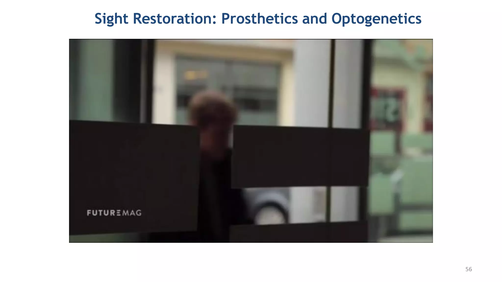 Sight Restoration: Prosthetics and Optogenetics
56
 