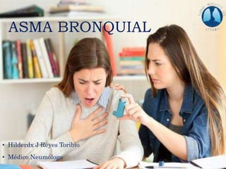 ASMA BRONQUIAL
• Hilderdx J Reyes Toribio
• Médico Neumólogo
 