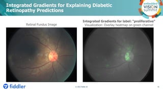 Integrated Gradients for Explaining Diabetic
Retinopathy Predictions
Retinal Fundus Image
Integrated Gradients for label: ...