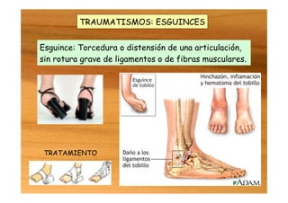 TRAUMATISMOS: ESGUINCES
Esguince: Torcedura o distensión de una articulación,
sin rotura grave de ligamentos o de fibras musculares.
TRATAMIENTO
 