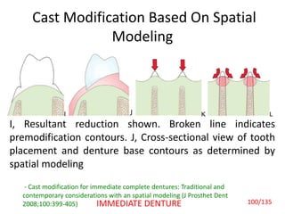 Cast Modification Based On Spatial
Modeling
I, Resultant reduction shown. Broken line indicates
premodification contours. J, Cross-sectional view of tooth
placement and denture base contours as determined by
spatial modeling
- Cast modification for immediate complete dentures: Traditional and
contemporary considerations with an spatial modeling (J Prosthet Dent
2008;100:399-405) 100/135IMMEDIATE DENTURE
 