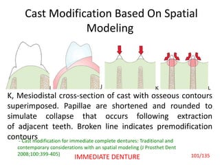 Cast Modification Based On Spatial
Modeling
K, Mesiodistal cross-section of cast with osseous contours
superimposed. Papillae are shortened and rounded to
simulate collapse that occurs following extraction
of adjacent teeth. Broken line indicates premodification
contours- Cast modification for immediate complete dentures: Traditional and
contemporary considerations with an spatial modeling (J Prosthet Dent
2008;100:399-405) 101/135IMMEDIATE DENTURE
 
