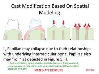 Cast Modification Based On Spatial
Modeling
L, Papillae may collapse due to their relationships
with underlying interradicular bone. Papillae also
may “roll” as depicted in Figure 5, H.
- Cast modification for immediate complete dentures: Traditional and
contemporary considerations with an spatial modeling (J Prosthet Dent
2008;100:399-405) 102/135IMMEDIATE DENTURE
 
