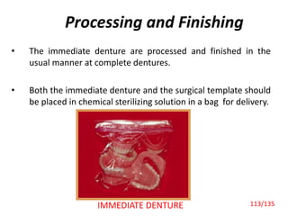 Processing and Finishing
• The immediate denture are processed and finished in the
usual manner at complete dentures.
• Both the immediate denture and the surgical template should
be placed in chemical sterilizing solution in a bag for delivery.
IMMEDIATE DENTURE 113/135
 