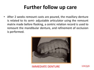 Further follow up care
• After 2 weeks remount casts are poured, the maxillary denture
is related to its semi- adjustable articulator using the remount
matrix made before flasking, a centric relation record is used to
remount the mandibular denture, and refinement of occlusion
is performed.
124IMMEDIATE DENTURE 124/135
 