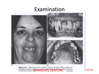 Examination
5353/135IMMEDIATE DENTURE
 