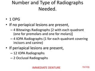 Number and Type of Radiographs
Needed.
• 1 OPG
• If no periapical lesions are present,
– 4 Bitewings Radiographs [2 with each quadrant
(one for premolars and one for molars)]
– 4 IOPA Radiographs (1 for each quadrant covering
incisors and canine)
• If periapical lesions are present,
– 12 IOPA Radiographs
– 2 Occlusal Radiographs
5555/135IMMEDIATE DENTURE
 