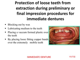 Protection of loose teeth from
extraction during preliminary or
final impression procedures for
immediate dentures
 Blocking out by wax
 Lubricating medium to the teeth
 Placing a vaccum formed plastic over
the teeth
 By placing loose fitting copper bands
over the extremely mobile teeth
61IMMEDIATE DENTURE 61/135
 