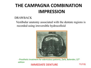 THE CAMPAGNA COMBINATION
IMPRESSION
DRAWBACK
Vestibular anatomy associated with the dentate regions is
recorded using irreversible hydrocolloid
71IMMEDIATE DENTURE
- Prosthetic treatment for edentulous patients, Zarb, Bolender, 12th
edition
71/135
 