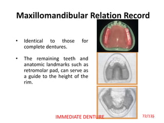 Maxillomandibular Relation Record
72
• Identical to those for
complete dentures.
• The remaining teeth and
anatomic landmarks such as
retromolar pad, can serve as
a guide to the height of the
rim.
IMMEDIATE DENTURE 72/135
 