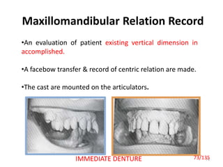 Maxillomandibular Relation Record
73
•An evaluation of patient existing vertical dimension in
accomplished.
•A facebow transfer & record of centric relation are made.
•The cast are mounted on the articulators.
IMMEDIATE DENTURE 73/135
 