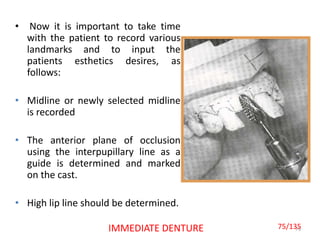 • Now it is important to take time
with the patient to record various
landmarks and to input the
patients esthetics desires, as
follows:
• Midline or newly selected midline
is recorded
• The anterior plane of occlusion
using the interpupillary line as a
guide is determined and marked
on the cast.
• High lip line should be determined.
75IMMEDIATE DENTURE 75/135
 