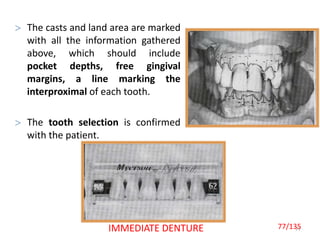 The casts and land area are marked
with all the information gathered
above, which should include
pocket depths, free gingival
margins, a line marking the
interproximal of each tooth.
 The tooth selection is confirmed
with the patient.
77IMMEDIATE DENTURE 77/135
 