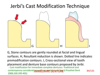 Jerbi’s Cast Modification Technique
G, Stone contours are gently rounded at facial and lingual
surfaces. H, Resultant reduction is shown. Dotted line indicates
premodification contours. I, Cross-sectional view of tooth
placement and denture base contours proposed by Jerbi.
- Cast modification for immediate complete dentures: Traditional and
contemporary considerations with an spatial modeling (J Prosthet Dent
2008;100:399-405)
84/135IMMEDIATE DENTURE
 