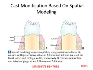 Cast Modification Based On Spatial
Modeling
95/135IMMEDIATE DENTURE
 
