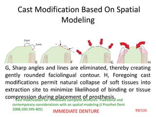Cast Modification Based On Spatial
Modeling
G, Sharp angles and lines are eliminated, thereby creating
gently rounded faciolingual contour. H, Foregoing cast
modifications permit natural collapse of soft tissues into
extraction site to minimize likelihood of binding or tissue
compression during placement of prosthesis.- Cast modification for immediate complete dentures: Traditional and
contemporary considerations with an spatial modeling (J Prosthet Dent
2008;100:399-405) 99/135IMMEDIATE DENTURE
 