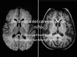 Desarrollo del cerebro de un
niño
Esperanza Povez Esteban
Universidad San Martin de Porres
 