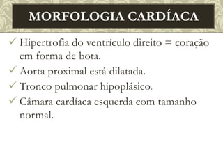  Hipertrofia do ventrículo direito = coração
em forma de bota.
 Aorta proximal está dilatada.
 Tronco pulmonar hipoplásico.
 Câmara cardíaca esquerda com tamanho
normal.
MORFOLOGIA CARDÍACA
 