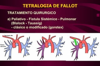 TETRALOGIA DE FALLOT TRATAMIENTO QUIRURGICO a) Paliativo - Fístula Sistémico - Pulmonar (Blalock - Taussig) - clásico o modificado (goretex) 