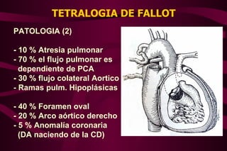 TETRALOGIA DE FALLOT PATOLOGIA (2) - 10 % Atresia pulmonar - 70 % el flujo pulmonar es dependiente de PCA - 30 % flujo colateral Aortico - Ramas pulm. Hipoplásicas - 40 % Foramen oval - 20 % Arco aórtico derecho - 5 % Anomalía coronaria (DA naciendo de la CD) 