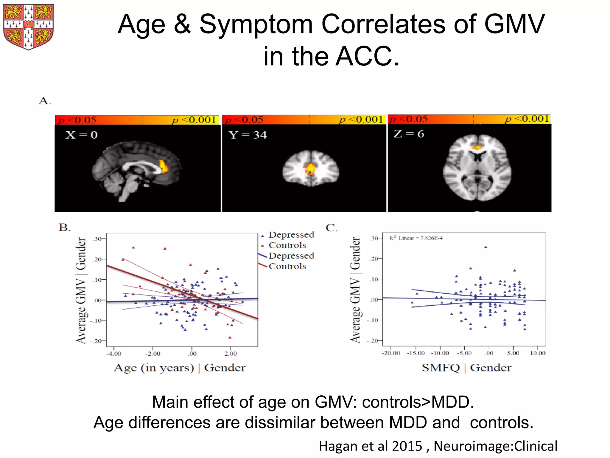Main effect of age on GMV: controls>MDD.
Age differences are dissimilar between MDD and controls.
Age & Symptom Correlates of GMV
in the ACC.
Hagan	
  et	
  al	
  2015	
  ,	
  Neuroimage:Clinical	
  
 