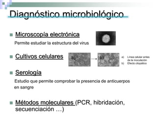 Diagnóstico microbiológico
 Microscopía electrónica
Permite estudiar la estructura del virus
 Cultivos celulares
 Serología
Estudio que permite comprobar la presencia de anticuerpos
en sangre
 Métodos moleculares (PCR, hibridación,
secuenciación …)
a) Línea celular antes
de la inoculación
b) Efecto citopático
a) b)
 